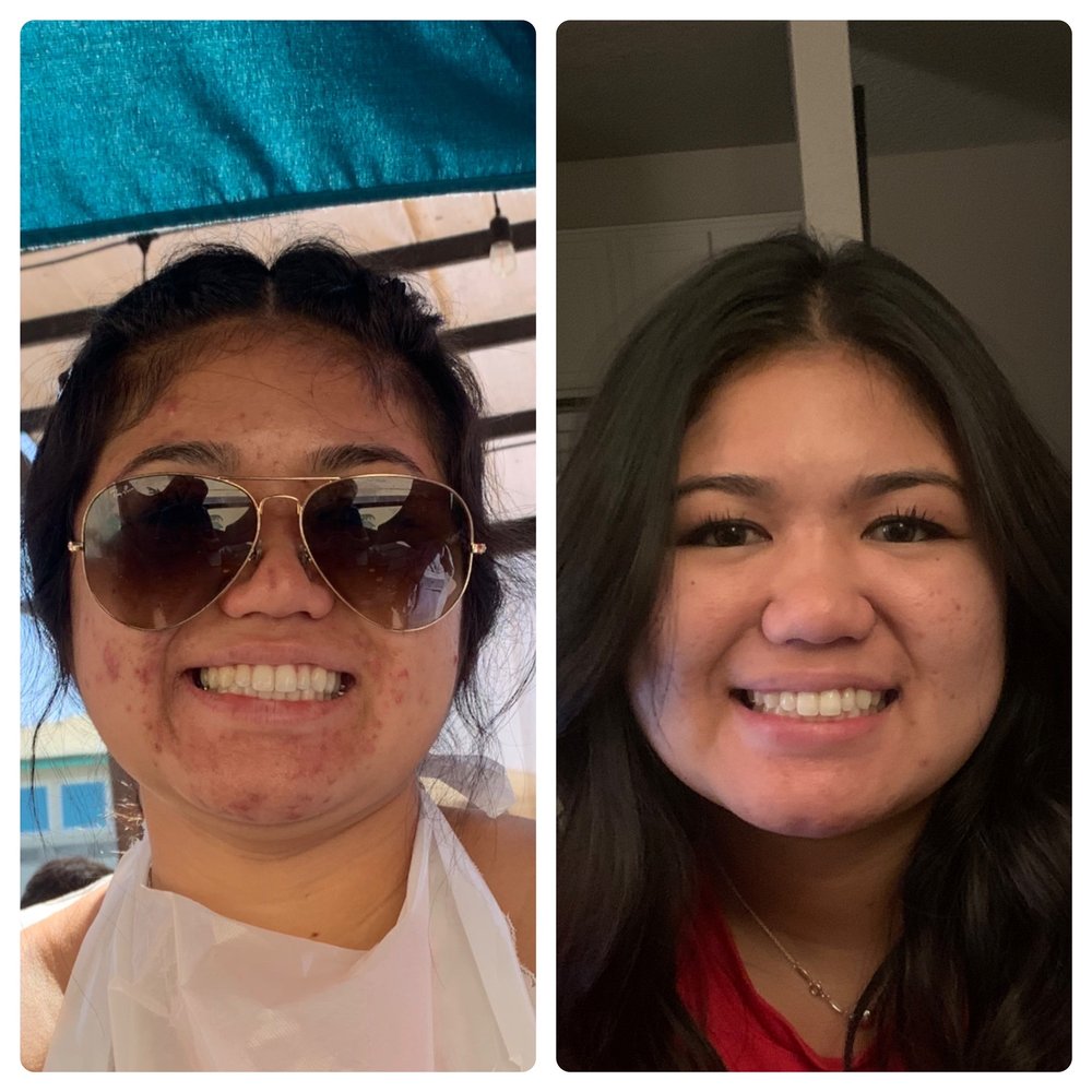 THE SKIN LIAISON INTEGRATIVE SKINCARE & ACNE CLINIC Updated May 2024