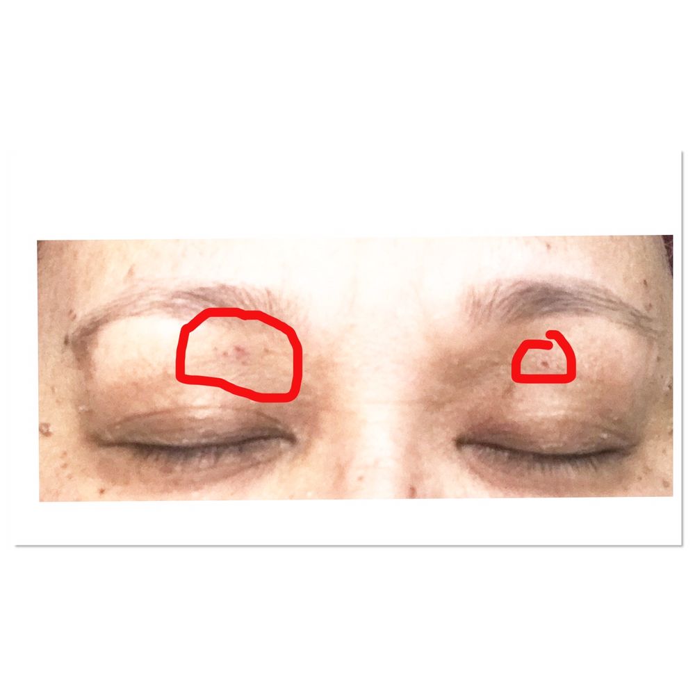 Twice the lady got my skin on the right eyelid. Once on my left eyelid. Twice the lady got my skin on the right eyelid. Once on my left eyelid.
