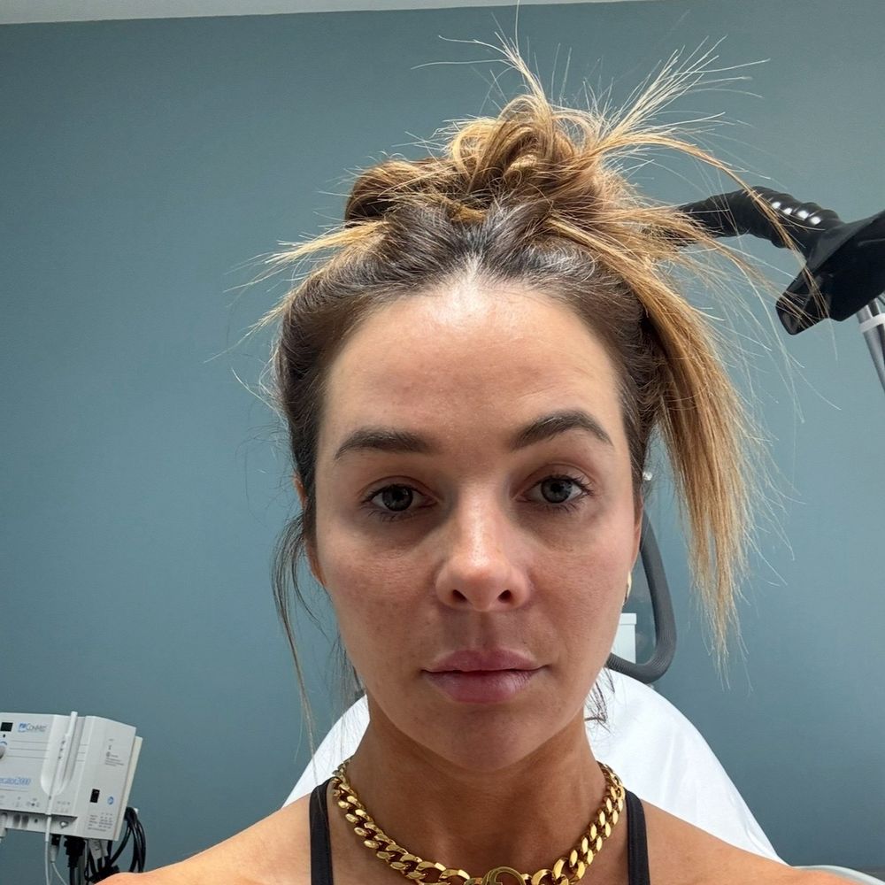 Ranch & Coast Plastic Surgery | Dr. Paul Chasan - Post op 5 months - Medical Spas Near Me - Del Mar, California Ranch & Coast Plastic Surgery | Dr. Paul Chasan - Post op 5 months - Medical Spas Near Me - Del Mar, California