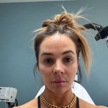 Ranch & Coast Plastic Surgery | Dr. Paul Chasan - Post op 5 months - Medical Spas Near Me - Del Mar, California Ranch & Coast Plastic Surgery | Dr. Paul Chasan - Post op 5 months - Medical Spas Near Me - Del Mar, California