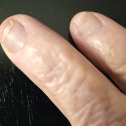 Luminous Nail Lounge - Damaged nails.