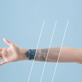 Family First Primary Care - Remove a unwanted tattoo! - Family Practice Near Me - Angleton, Texas Family First Primary Care - Remove a unwanted tattoo! - Family Practice Near Me - Angleton, Texas