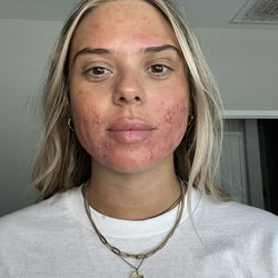 Before skincare routine