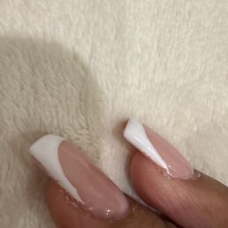 Ugly nails Ugly nails