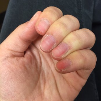 Bellazzio Nails Spa - My nails after taking the set off - pinky nail splitting on the side - Nail Salons Near Me - Corona, California
