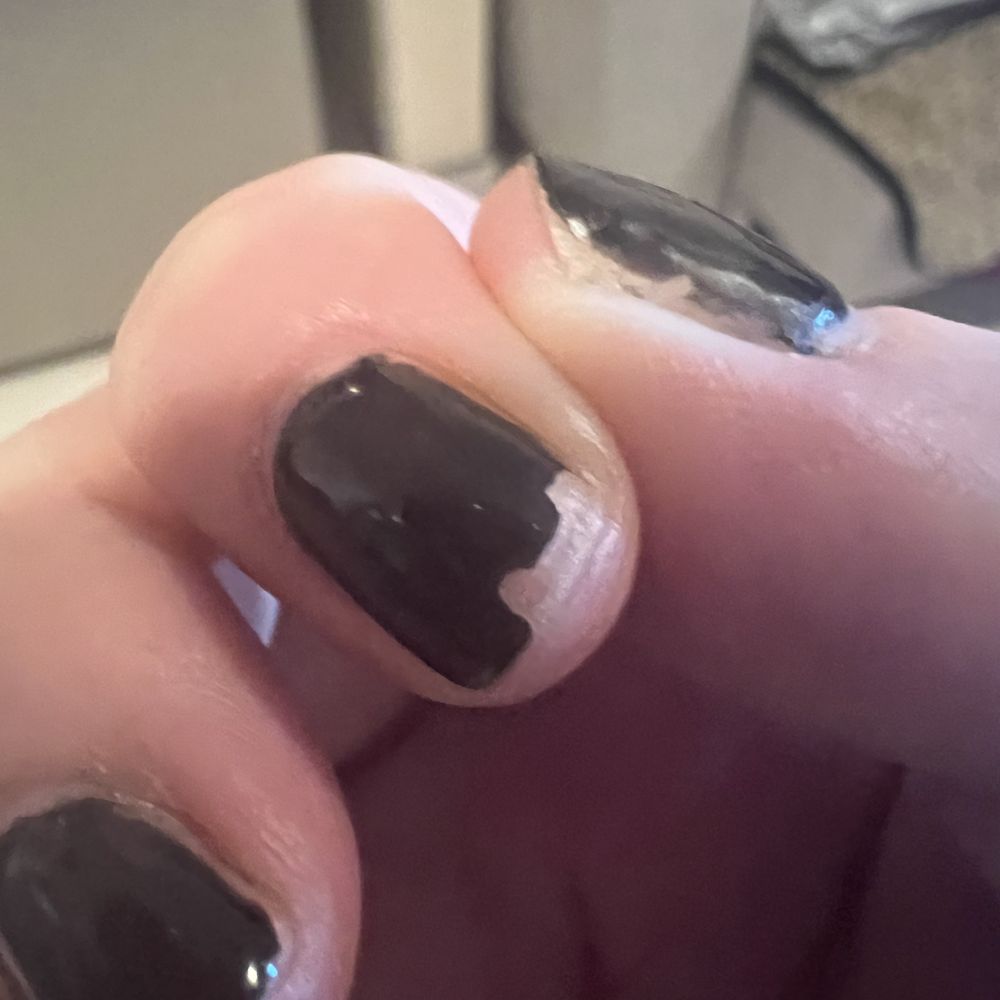 Robert Abuda Salon - Massive chip, ovviously. Uneven on thumb, general unevenness at cuticle edge. - Hair Salons Near Me - Mérida, YUC Robert Abuda Salon - Massive chip, ovviously. Uneven on thumb, general unevenness at cuticle edge. - Hair Salons Near Me - Mérida, YUC
