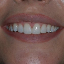 David Carroll, DMD - After