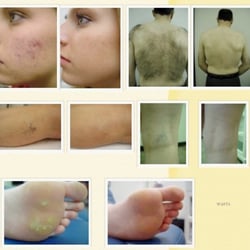Enliven MD Skin and Laser - Before and After Pictures