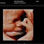 Peek A Boo Baby 3D 4D Ultrasound