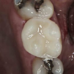 Sipes Dental