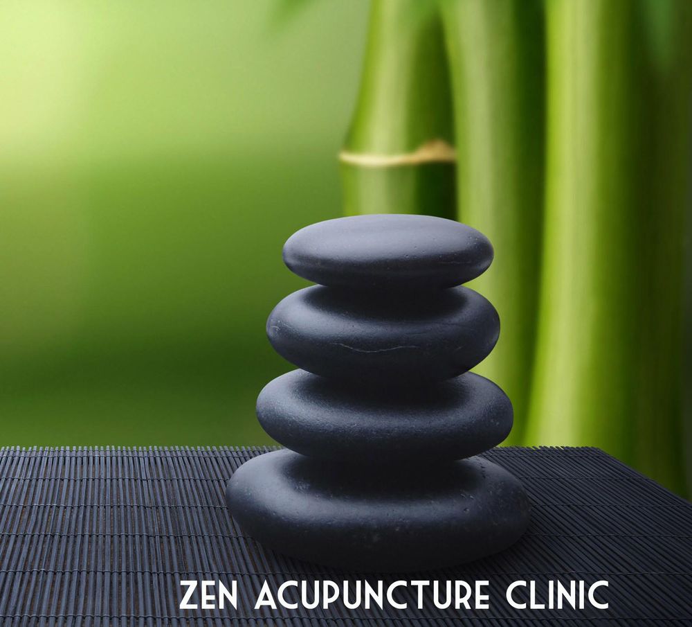 ZEN ACUPUNCTURE CLINIC Updated August 2024 1717 N Milpitas Blvd