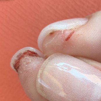Lucky Nails & Spa - If I could get it to stop bleeding everytime I try to see the cut I'd get a better picture. - Nail Salons Near Me - Morganton, North Carolina