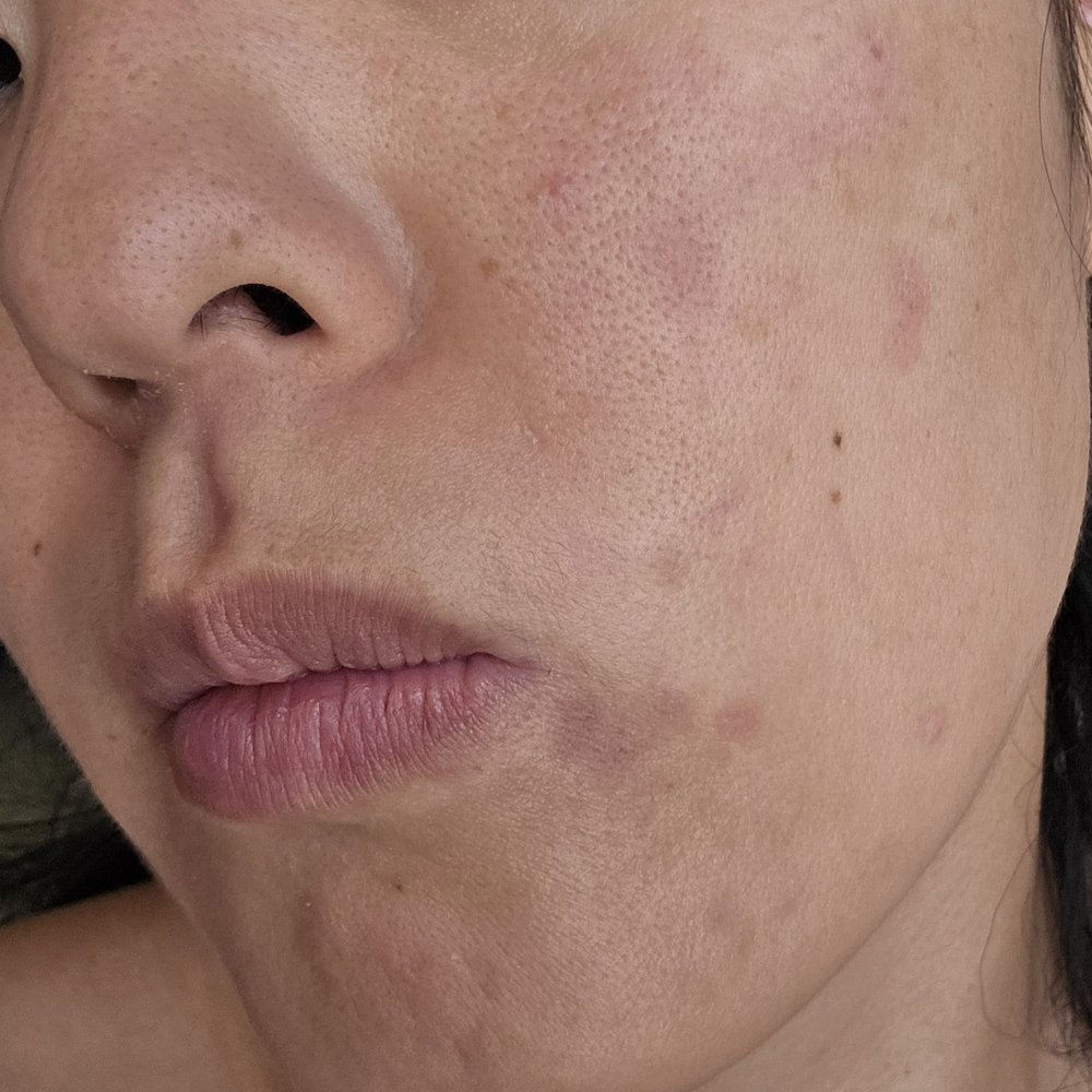 Oculofacial Plastic Surgery Hawaii - Skin has never looked this bad in my life! - Cosmetic Surgeons Near Me - Honolulu, Hawaii Oculofacial Plastic Surgery Hawaii - Skin has never looked this bad in my life! - Cosmetic Surgeons Near Me - Honolulu, Hawaii