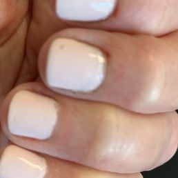 Nipped cuticles Nipped cuticles