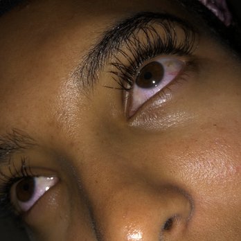 Broadway Skincare - My eyes were bloodshot for a good 3-4 days. - Eyelash Service Near Me - Aliso Viejo, California Broadway Skincare - My eyes were bloodshot for a good 3-4 days. - Eyelash Service Near Me - Aliso Viejo, California