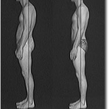 Ceridwen E McKenna - Magical Shift - Before and after, photo from the archives of Rolf Institute(R) for Structural Integration - Naturopathic/Holistic Near Me - Providence, Rhode Island Ceridwen E McKenna - Magical Shift - Before and after, photo from the archives of Rolf Institute(R) for Structural Integration - Naturopathic/Holistic Near Me - Providence, Rhode Island