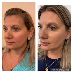 Illume Medical Spa