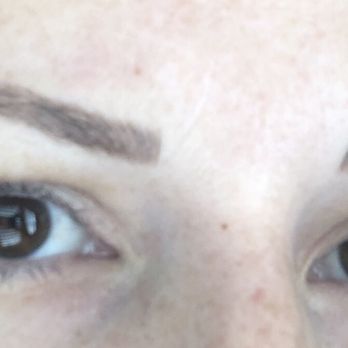The Highbrow - Still healing after second visit still healing - Hair Removal Near Me - Newport Beach, California The Highbrow - Still healing after second visit still healing - Hair Removal Near Me - Newport Beach, California