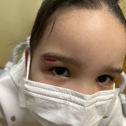 Stony Brook University Hospital - Here's my daughter's nice gash she was left sitting with for five hours.