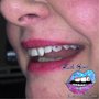 Photo of Tooth Gems by Pinky