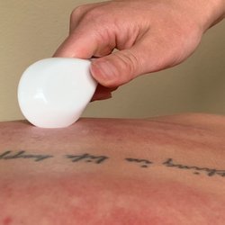 Healthy Living Acupuncture and Wellness - Guasha is a modality of TCM that we use with acupuncture to free the qi!
