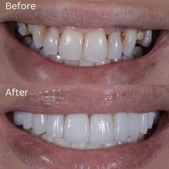 Restore Dental - Cosmetic Dentists Near Me - Los Angeles, California Restore Dental - Cosmetic Dentists Near Me - Los Angeles, California