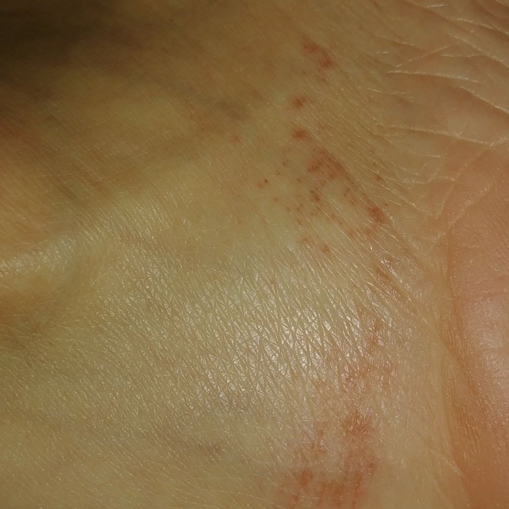 Lush Nail & Spa  - My poor foot! I felt like this was the first pedicure she's ever given! 24 hours later and still hurting. - Day Spas Near Me - New York, New York