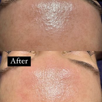 Groovy Glow Esthetics - Estheticians Near Me - New Braunfels , Texas Groovy Glow Esthetics - Estheticians Near Me - New Braunfels , Texas