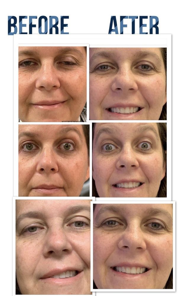 IRVINE ACUPUNCTURE 35 Photos & 95 Reviews 4001 Westerly Pl, Newport