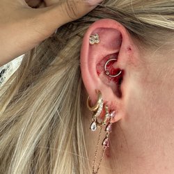 This is what my ear looked like after he "cleaned it up"