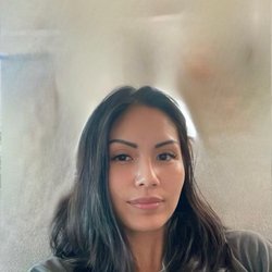 Medspa of Austin - My wrinkles are gone!