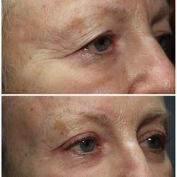 Aesthetic Eye Care