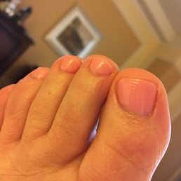 Wrinkled varnish like custard skin!! Wrinkled varnish like custard skin!!