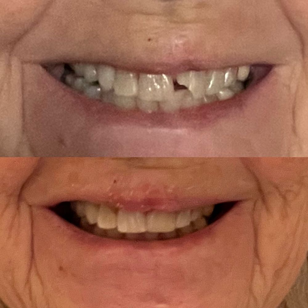 89A Dental Care - Repair - Cosmetic Dentists Near Me - Prescott Valley, Arizona 89A Dental Care - Repair - Cosmetic Dentists Near Me - Prescott Valley, Arizona
