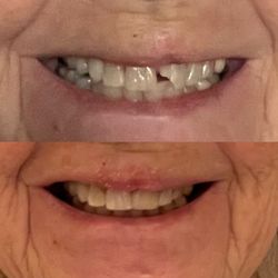 89A Dental Care - Repair
