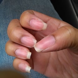 Top Nails - Nail cuticles are all lifted. One nail broken (middle finger).