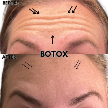 Luxury Recovery Spa - Botox - IV Hydration Near Me - Escondido, California Luxury Recovery Spa - Botox - IV Hydration Near Me - Escondido, California