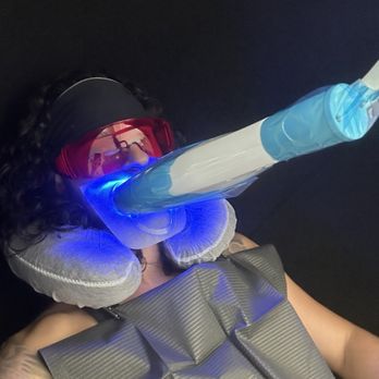 Teeth Whitening Lab - Teeth Whitening Near Me - Long Beach, California Teeth Whitening Lab - Teeth Whitening Near Me - Long Beach, California
