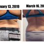 Photo of Orlando Laser Lipo Services