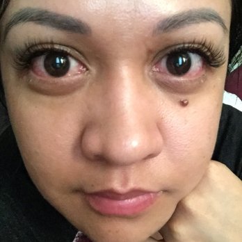Amazing Lash Studio - Houston Eyelash Extensions - My eyes were like this for 3-4 days after I got my full set at Amazing Lash Studio. - Eyelash Service Near Me - Houston, Texas