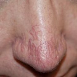 Softouch Permanent Makeup