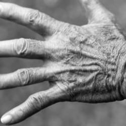 Center For Stroke & Hand Recovery - Center For Stroke & Hand Recovery