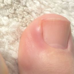 I got a toe infection from this nail salon I got a toe infection from this nail salon