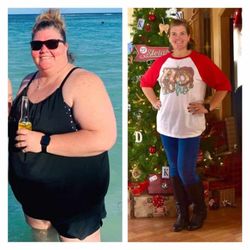 BodEvolve Bariatric & Cosmetic Surgery - Total transformation!