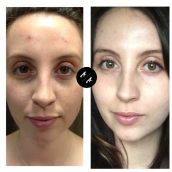 Angel Aesthetics - Medical Spas Near Me - Denver, Colorado Angel Aesthetics - Medical Spas Near Me - Denver, Colorado