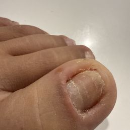 YELLOW, cracky nail. Never has happened in my life. YELLOW, cracky nail. Never has happened in my life.