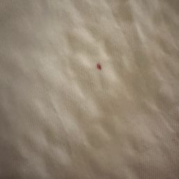 One of many blood spots found on bedding. One of many blood spots found on bedding.