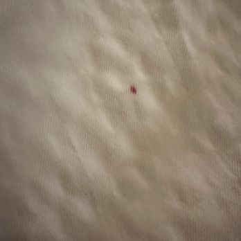 Inn at Port Gardner-Everett Waterfront, Ascend Hotel Collection - One of many blood spots found on bedding. - Hotels Near Me - Everett, Washington Inn at Port Gardner-Everett Waterfront, Ascend Hotel Collection - One of many blood spots found on bedding. - Hotels Near Me - Everett, Washington
