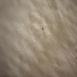 Inn at Port Gardner-Everett Waterfront, Ascend Hotel Collection - One of many blood spots found on bedding.