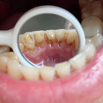 ismile Dental Center - Cosmetic Dentists Near Me - Jackson Heights, New York